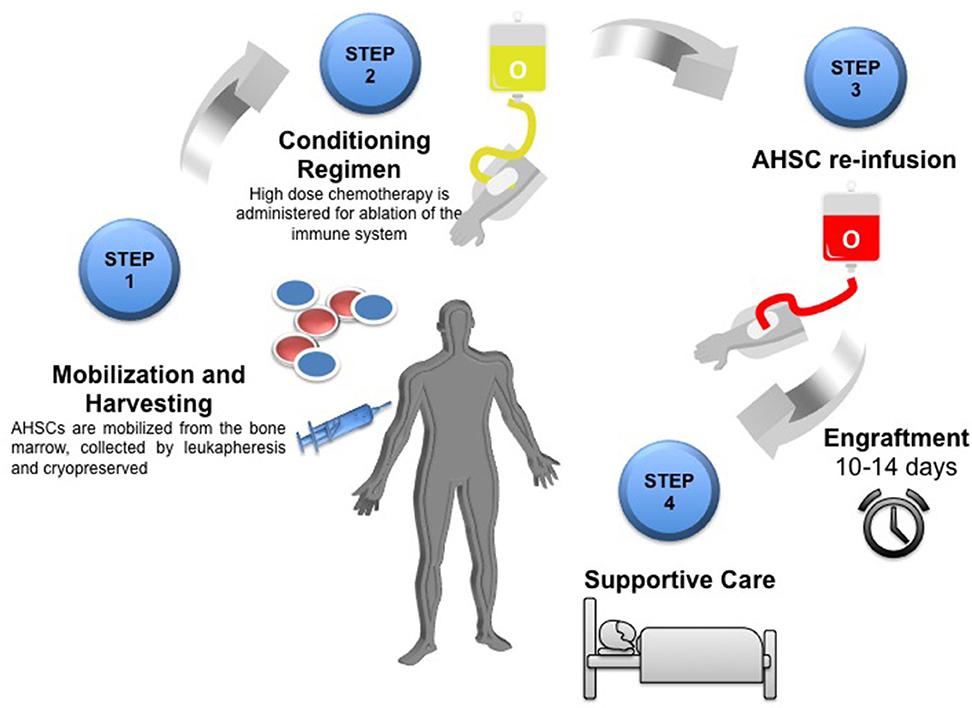 A graphical representation of stem cell transplantation in a patient with Multiple Sclerosis